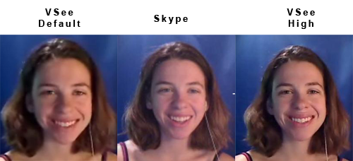 Skype video quality